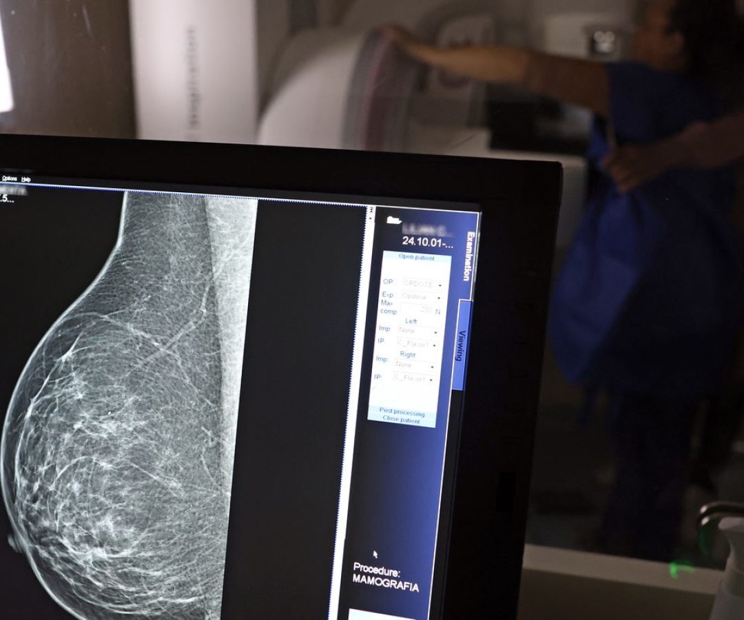 Plano de saúde terá que cobrir mamografia digital para todas as idades