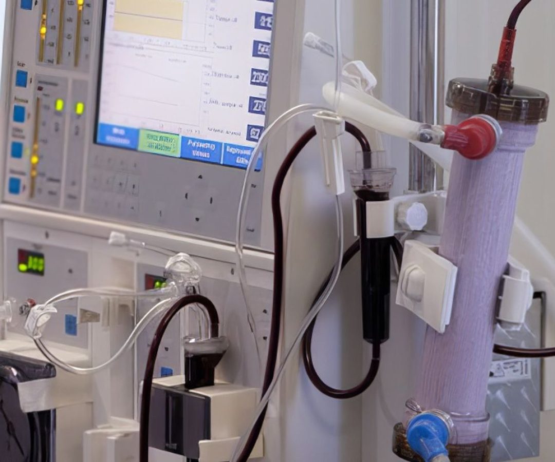 Estudo alerta para subdiagnóstico da doença renal crônica no Brasil
