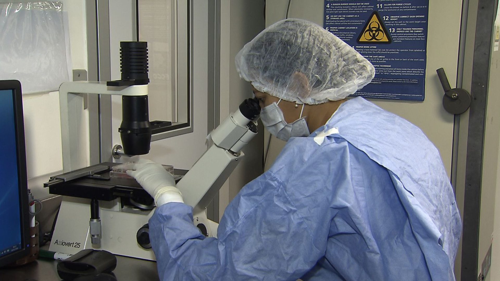 Como cientistas "curaram" pacientes infectados com HIV