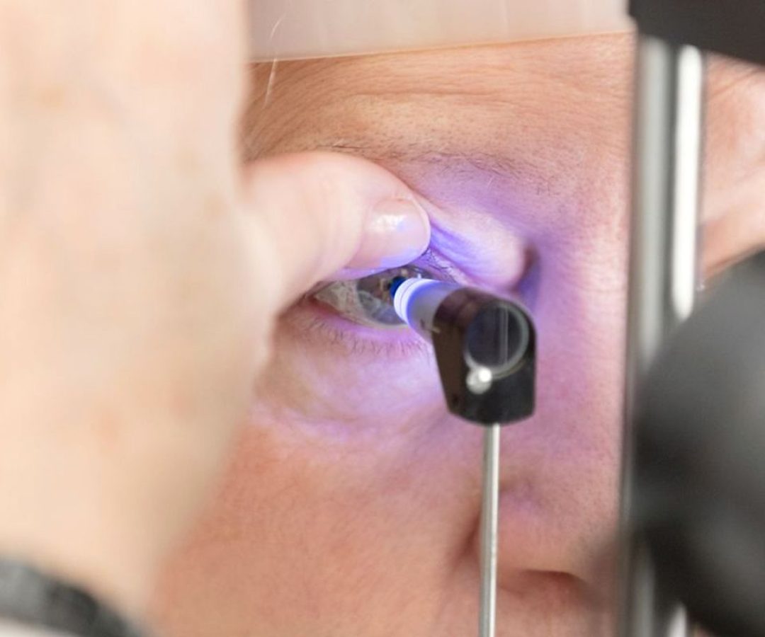 Saiba qual é a rotina ideal de consultas para cuidar da visão